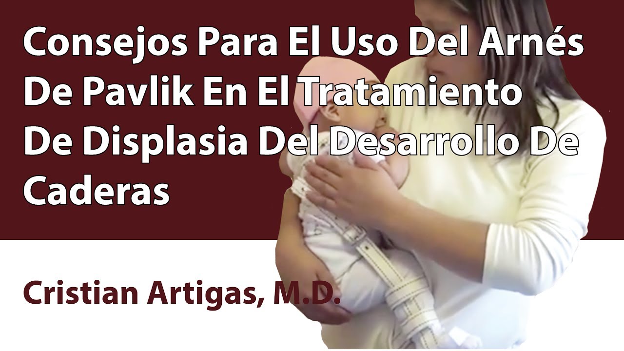 displasia de cadera en bebes tratamiento fisioterapeutico