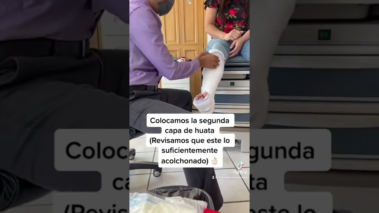 fibra de vidrio para inmovilizar fracturas