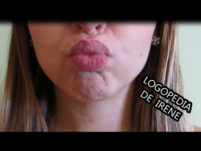 imagenes de praxias linguales y labiales