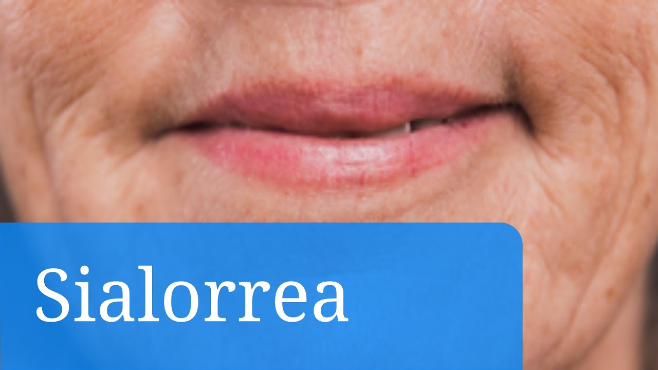 como evitar el exceso de saliva en la boca