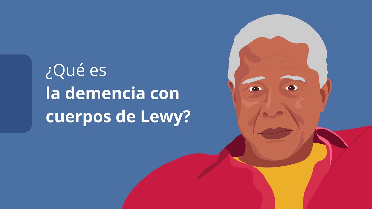 demencia de cuerpos de lewy fases