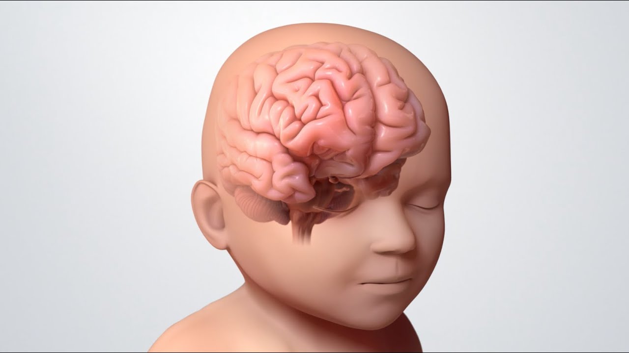 epilepsia en bebes de 1 año