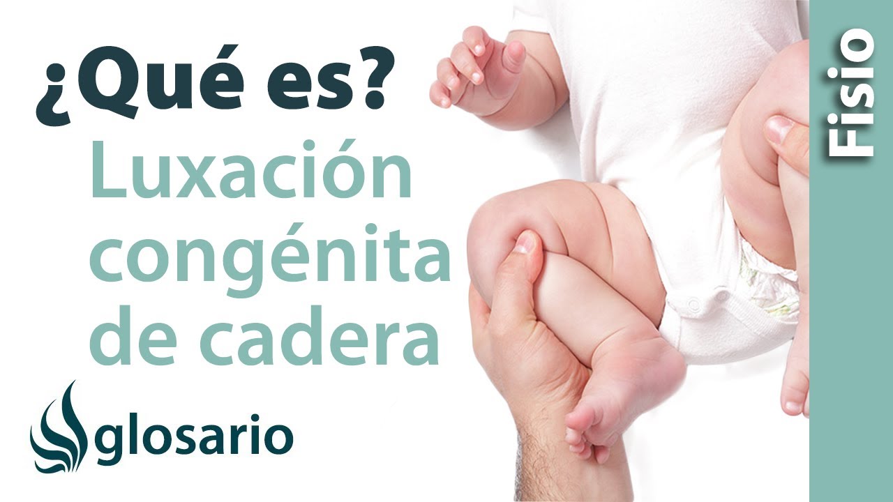 luxacion congenita de cadera en adultos