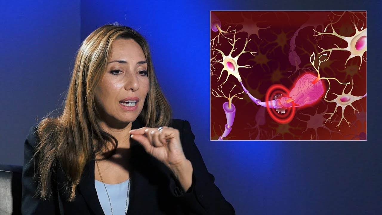 pruebas para saber si tienes esclerosis multiple