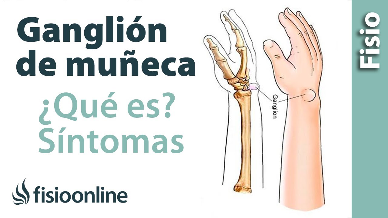 que es un flojo en la mano