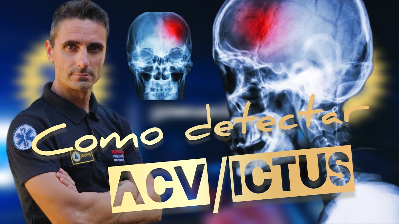 como actuar en caso de ictus