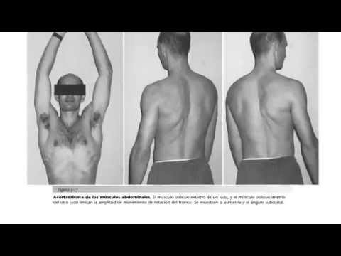 diagnostico y tratamiento de las alteraciones del movimiento