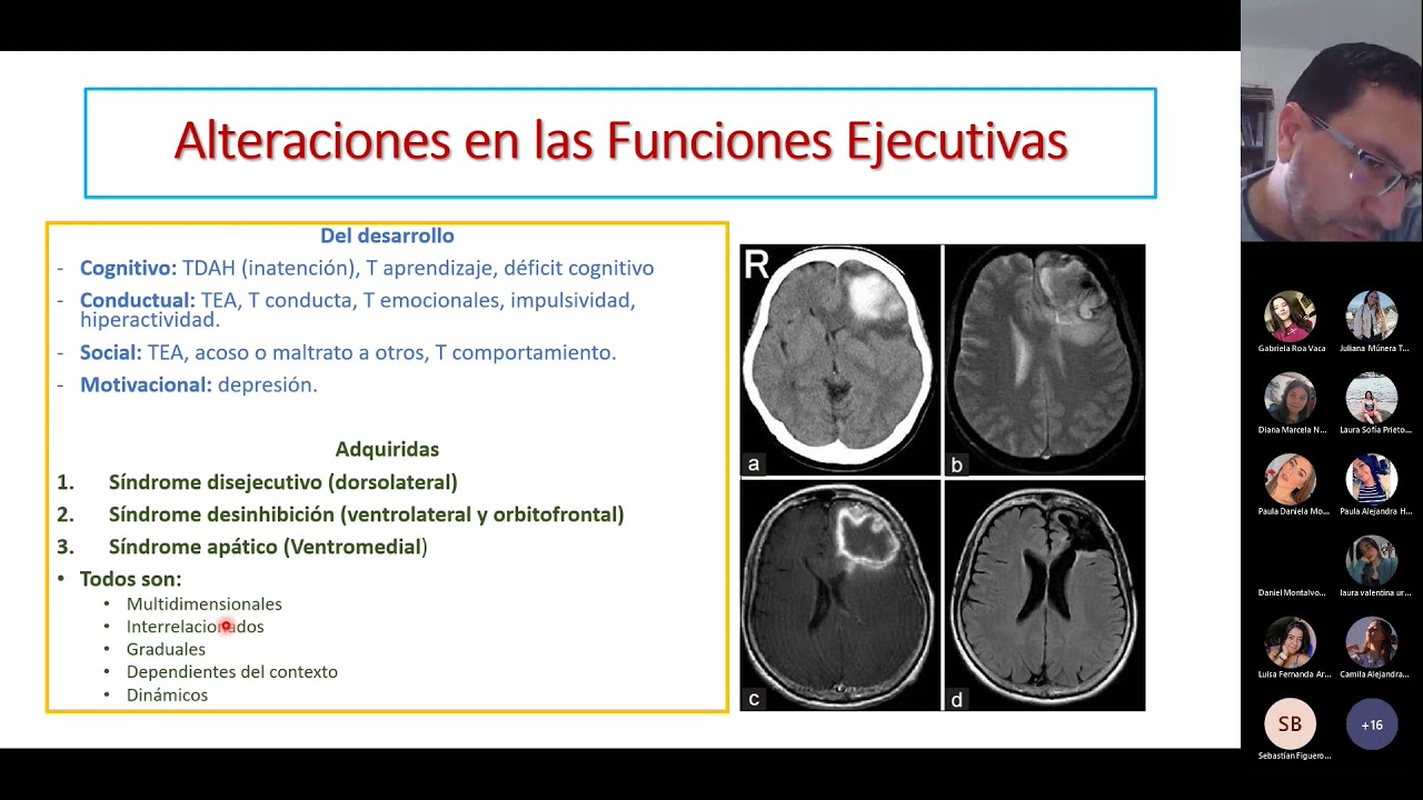 funciones ejecutivas afectadas por el alzheimer