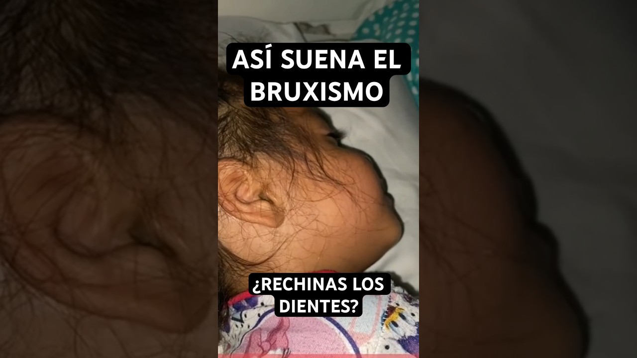niño rechina los dientes al dormir