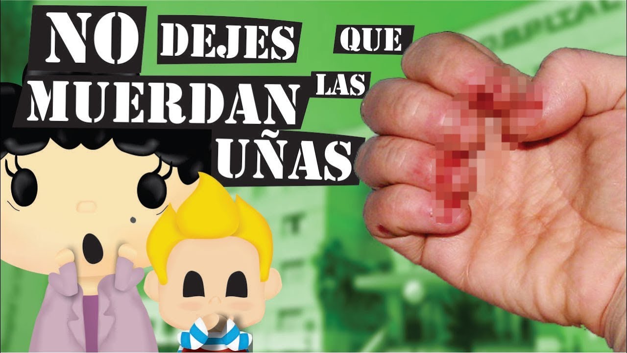 porque se come las uñas mi hijo