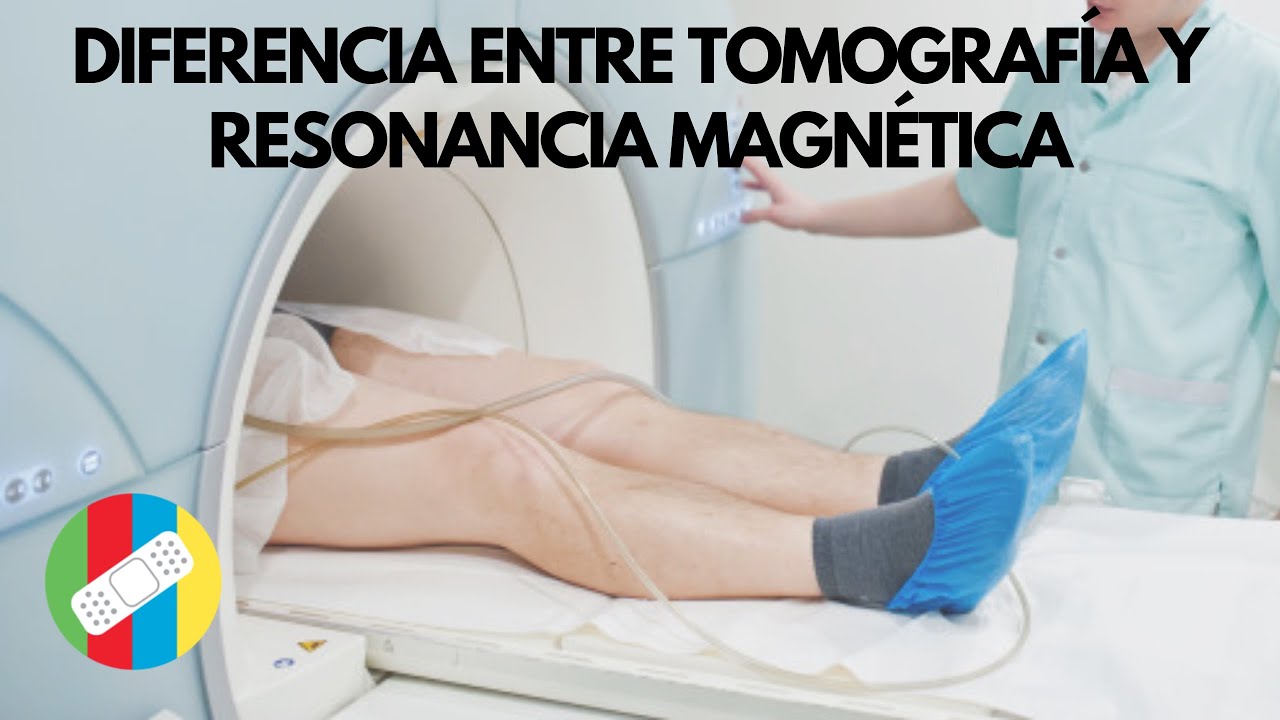 diferencia entre tac y resonancia magnetica cerebral