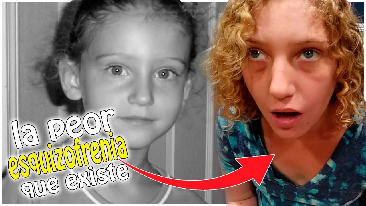 el peor caso de esquizofrenia infantil