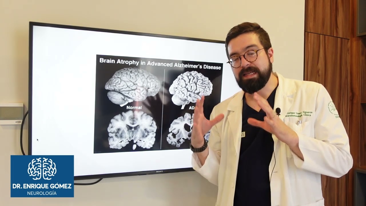 qué es una atrofia en el cerebro